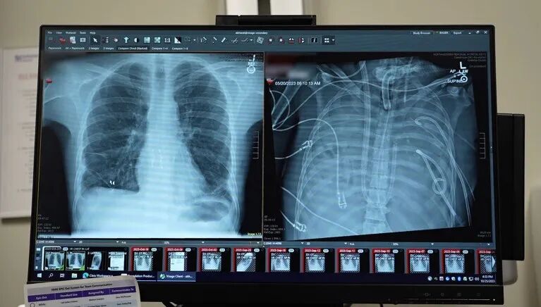 A view of two x-rays displayed on a digital monitor
