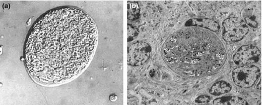 Bradyzoite cyst and morphology. (a) Phase image of a brain cyst harboring hundreds of bradyzoites isolated from a chronically infected mouse. Image courtesy of Dr L.M. Weiss, Albert Einstein College of Medicine. (b) Electron micrograph shows details of bradyzoites within an intracellular tissue cyst. Note the posterior location of the parasite nucleus and abundance of amylopectin granules (white) and micronemes (black). Image courtesy of Dr David Ferguson, University of Oxford.