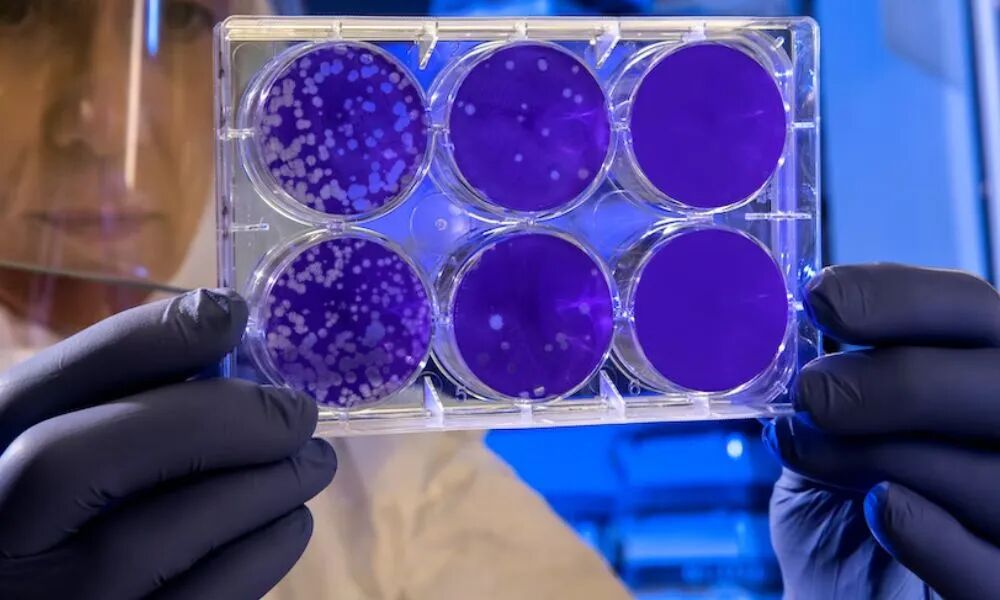 malassezia biofilm petri dish