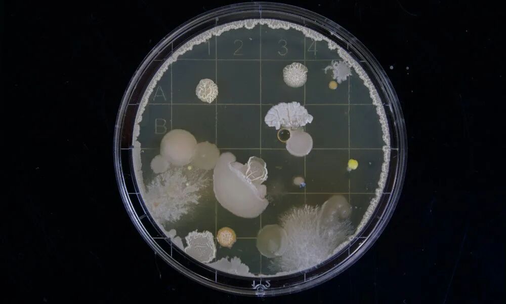 The Complete Guide to Malassezia: Causes, Biofilm, Treatment, and Prevention
