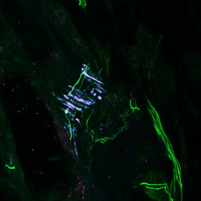 A new clue to how the body detects physical force