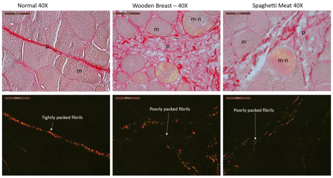 Characterization of Collagen Structure in Normal, Wooden Breast and Spaghetti Meat Chicken Fillets by FTIR Microspectroscopy and Histology