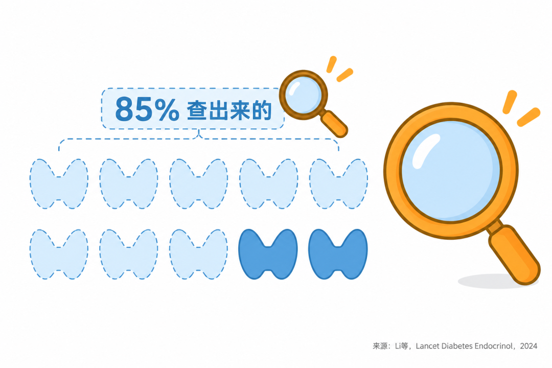 甲状腺癌超85%是筛查查出来的