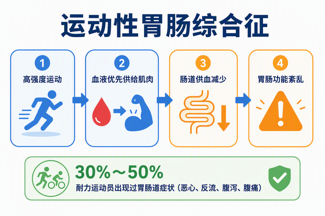 运动性胃肠综合征机制示意