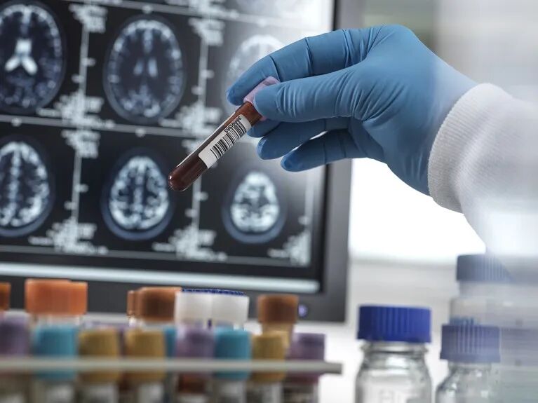 A hand in PPE holding a blood sample vial with a screen of brain MRIs in the background.