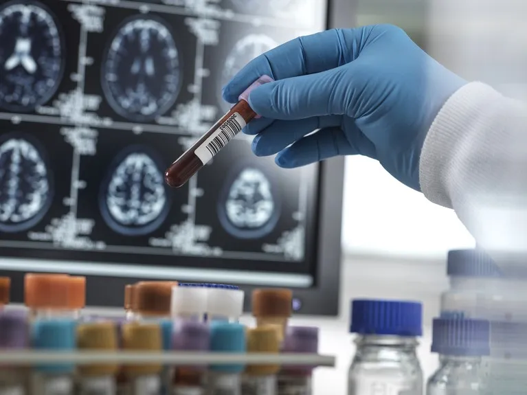 A hand in PPE holding a blood sample vial with a screen of brain MRIs in the background.