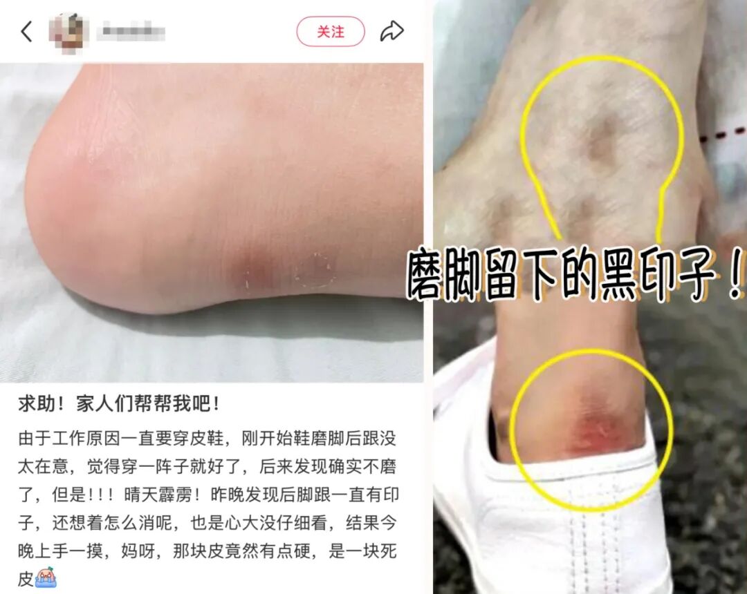 磨脚.jpg