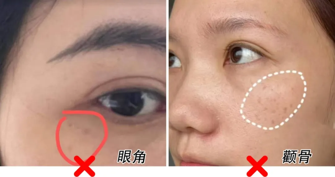 晒到眼角.jpg