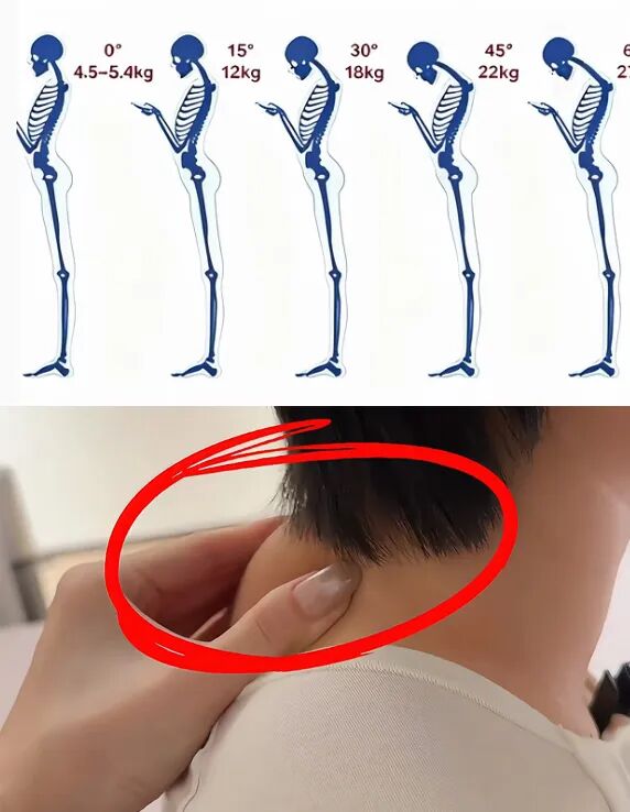 颈椎完了.jpg