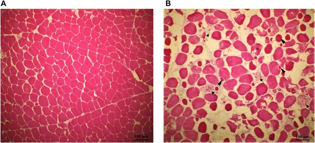 Frontiers | Biochemical and Physicochemical Changes in Spaghetti Meat During Refrigerated Storage of Chicken Breast