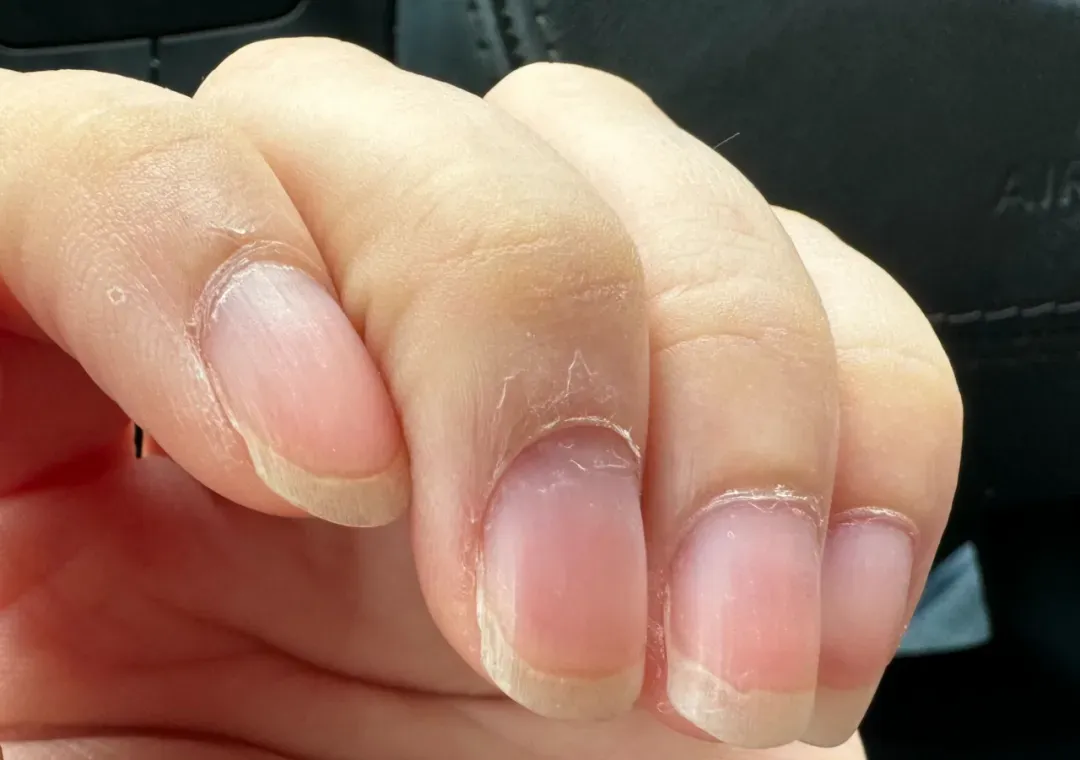 descript