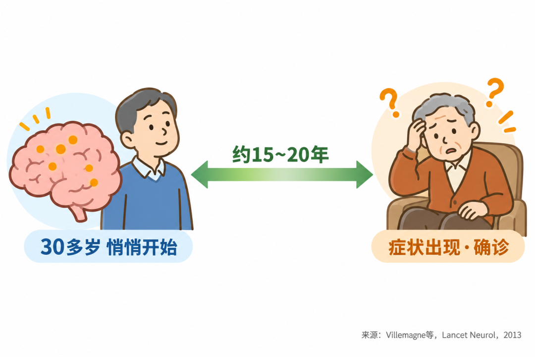 病理改变比症状早15~20年
